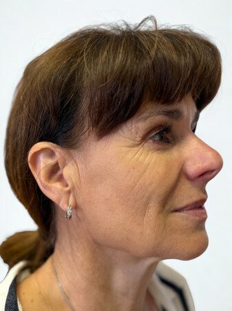 Před zákrokem